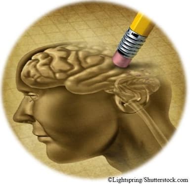 New Data Support Lecanemab Long-Term Dosing in Alzheimer Disease and Benefit In Earliest Stage / image credit ©Lightspring/Shuttestock.com