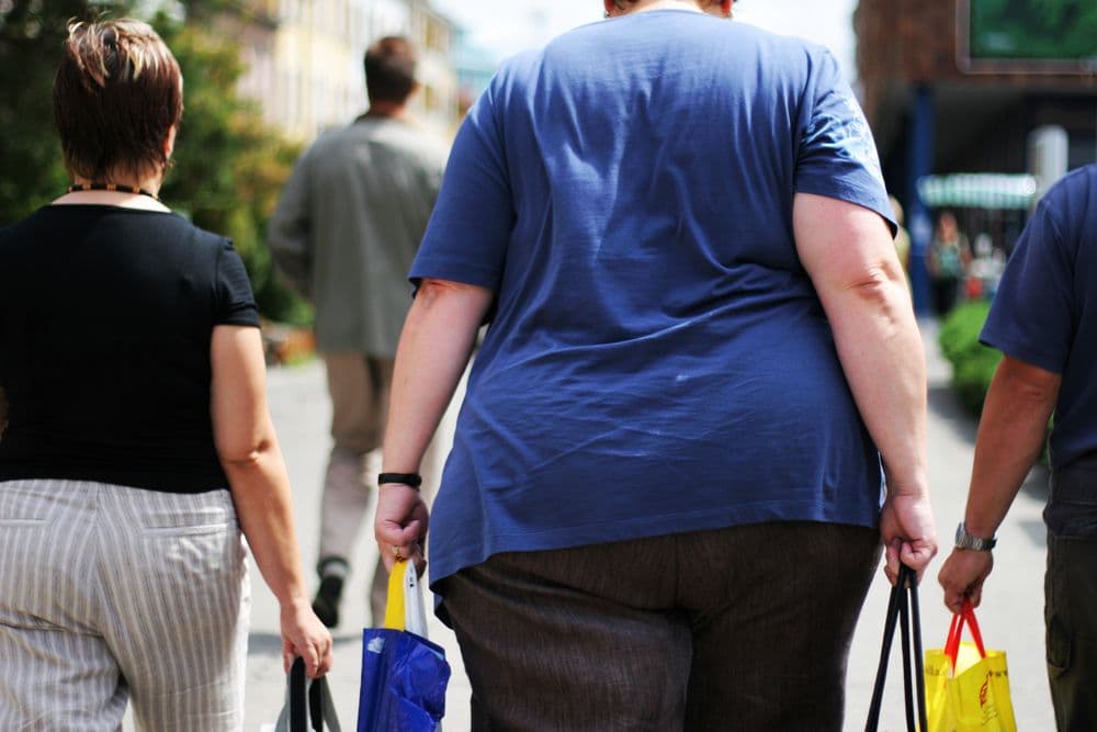 Obesity. ©Jakub Cejpek/Shutterstock.com